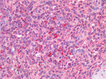 CD33 Antibody