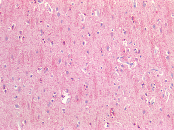 CD81 Antibody