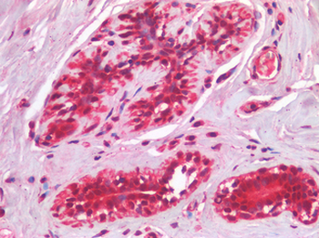 IL3RA/CD123 Antibody