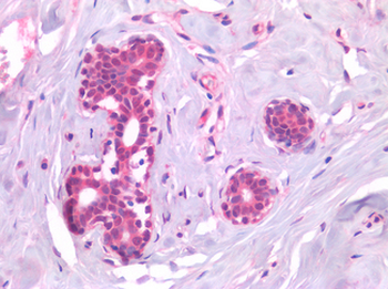 AML1/RUNX1 Antibody
