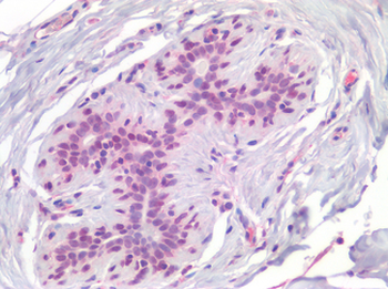 AML1/RUNX1 Antibody
