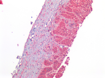AGTR2/AT2 Receptor Antibody