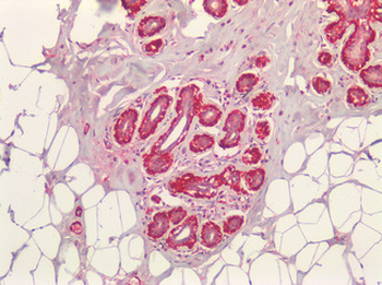 ACTA2/Smooth Muscle Actin Antibody