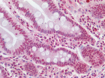 SNAI1/SNAIL-1 Antibody