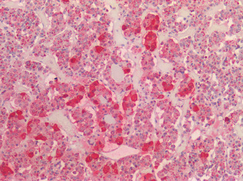 POMC/Proopiomelanocortin Antibody