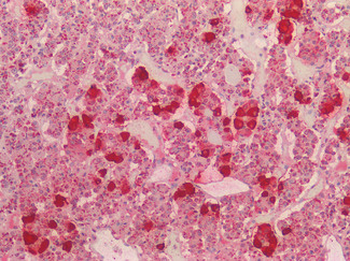 POMC/Proopiomelanocortin Antibody