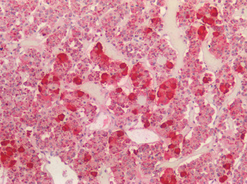 POMC/Proopiomelanocortin Antibody