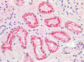 TMPRSS2/Epitheliasin Antibody