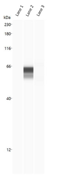 ACE2/ACE-2 Antibody