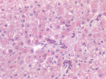 CD4 Antibody