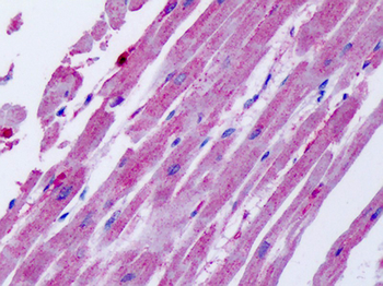 ACKR4/CCRL1/CCR11 Antibody