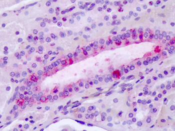 ADGRL3/LPHN3 Antibody