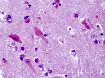 GPR83 Antibody