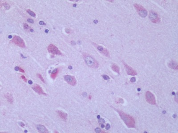 GPR6 Antibody