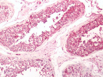 GPR6 Antibody