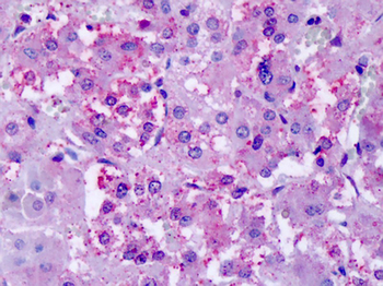 CHRM2/M2 Antibody