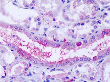 GPR80/GPR99/OXGR1 Antibody