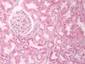 ADGRD1/GPR133 Antibody