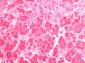 ADGRD1/GPR133 Antibody