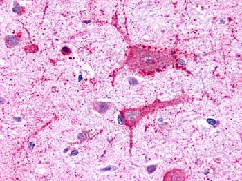 GALR3/Galanin Receptor 3 Antibody