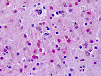 RORA/ROR Alpha Antibody