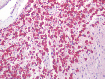OXTR/Oxytocin Receptor Antibody