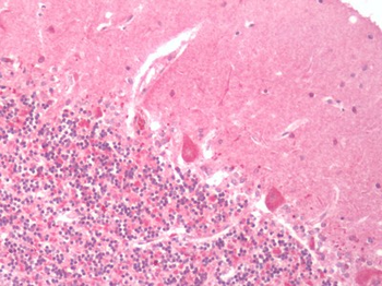 PTHR2/PTH2R Antibody