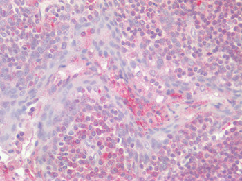 F2RL2/PAR3 Antibody