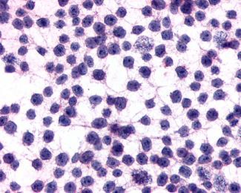 ADGRE5/CD97 Antibody