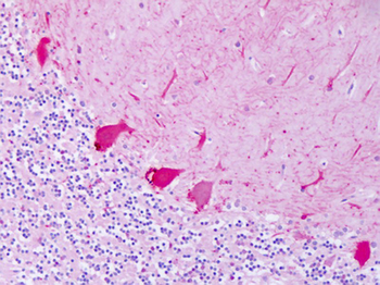 ADRB2 Antibody