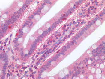 C3AR/C3a Receptor Antibody