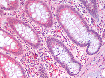 SLC5A4/SGLT3 Antibody