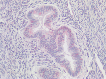 DKK1 Antibody