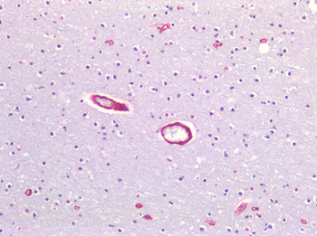 CAV1/Caveolin 1 Antibody