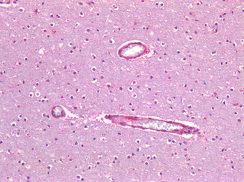 CAV1/Caveolin 1 Antibody