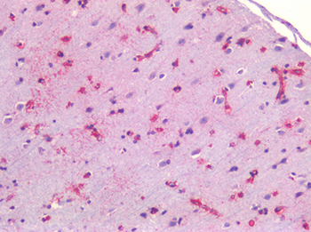 CAV1/Caveolin 1 Antibody