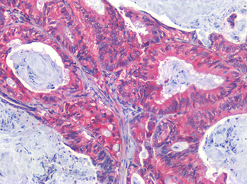 EPHB2/EPH Receptor B2 Antibody