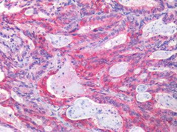 EPHB2/EPH Receptor B2 Antibody
