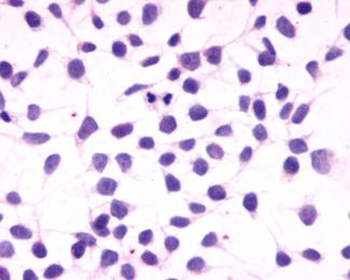 CNR1/CB1 Antibody