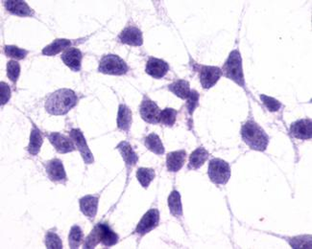 GRM3/MGLUR3 Antibody