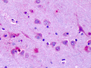 OR6N1 Antibody
