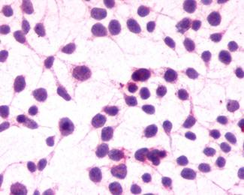 CNR1/CB1 Antibody