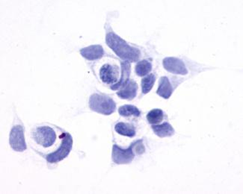 GPR161 Antibody