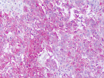 GPR161 Antibody