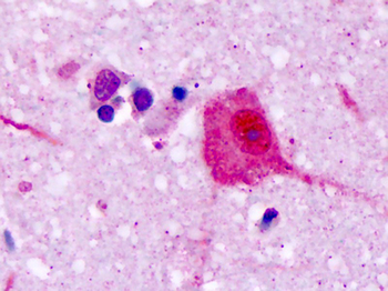 V1RL1/VN1R1 Antibody