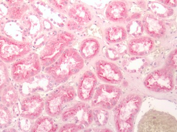 FZD2/Frizzled 2 Antibody