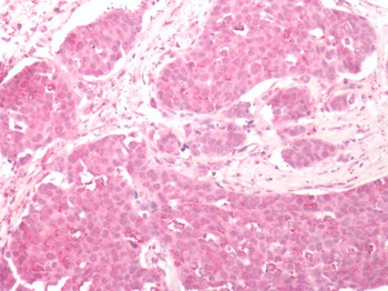 FZD2/Frizzled 2 Antibody