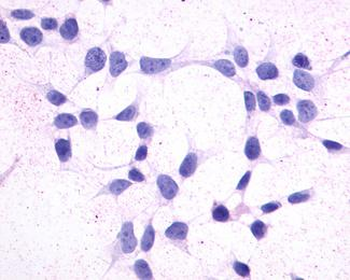 GPR44/CRTH2 Antibody