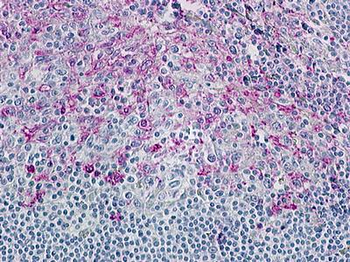 CCR8/CD198 Antibody