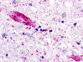 ACKR2/CCR10/D6 Antibody